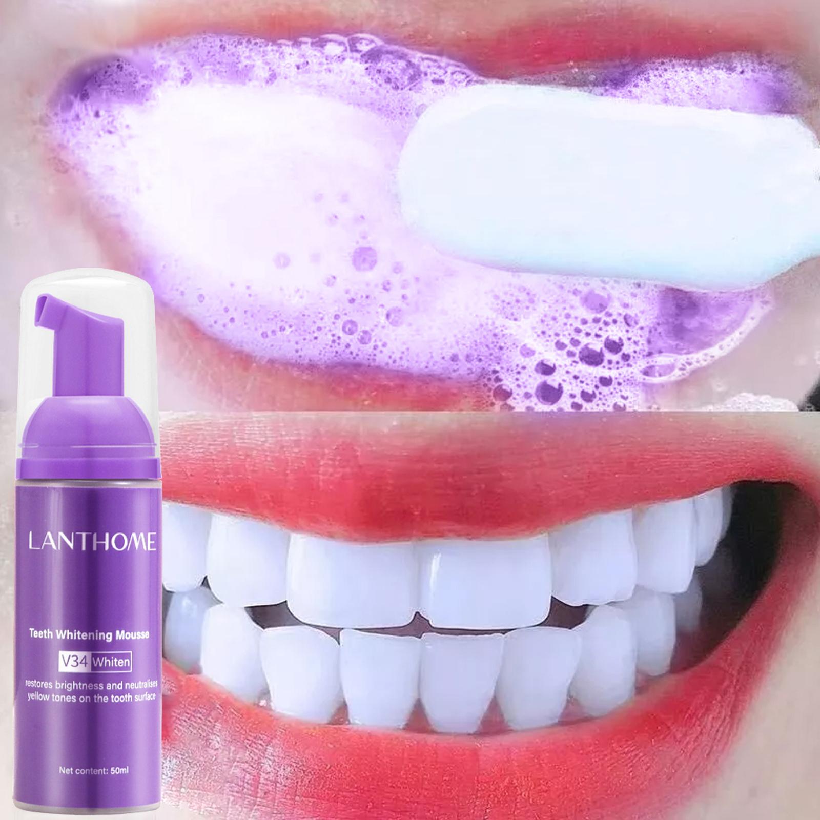 Teeth Whitening Best - Pasta de dientes V34 Mousse para