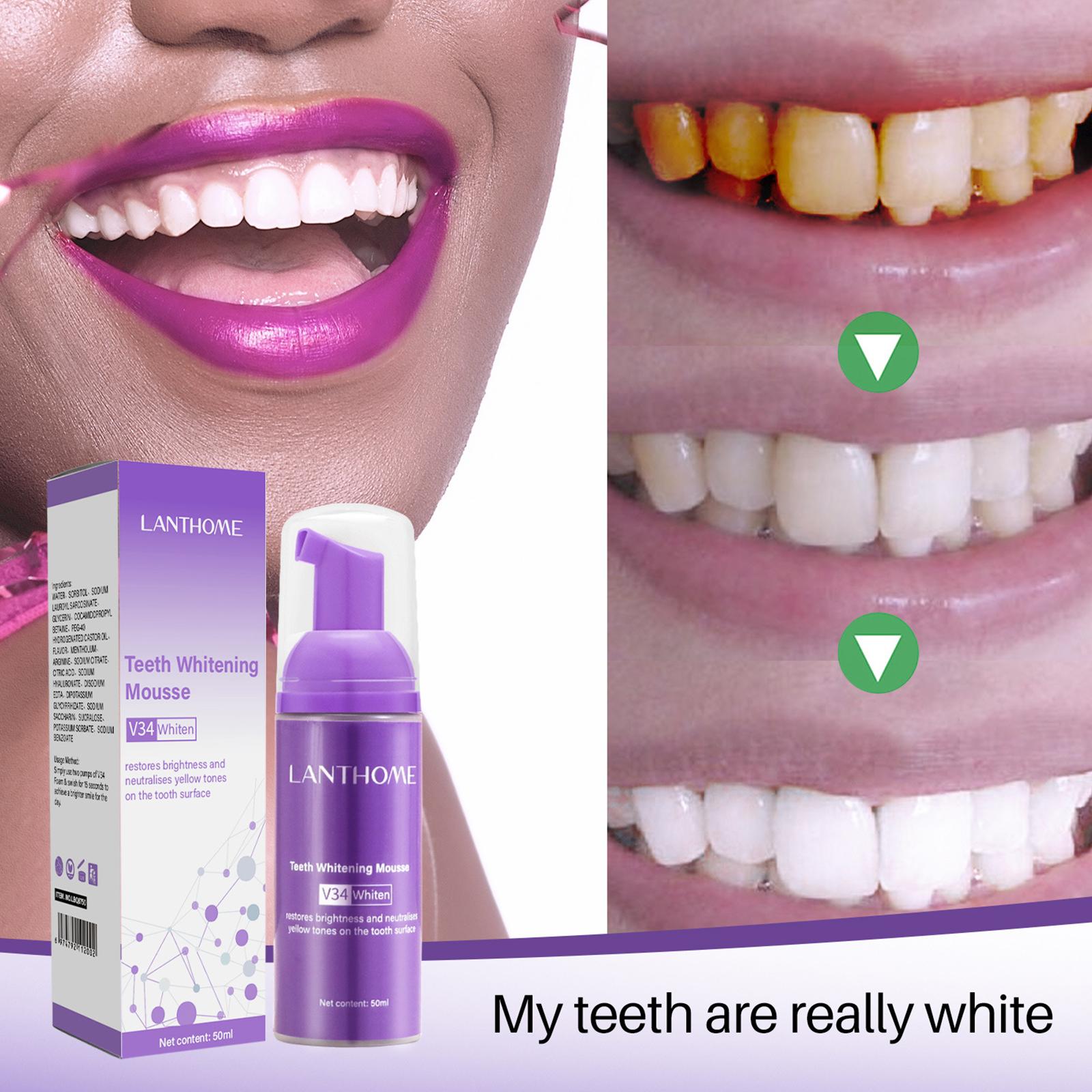 Pasta de dientes V34 Mousse pa - Teeth Whitening Best reseña y precio