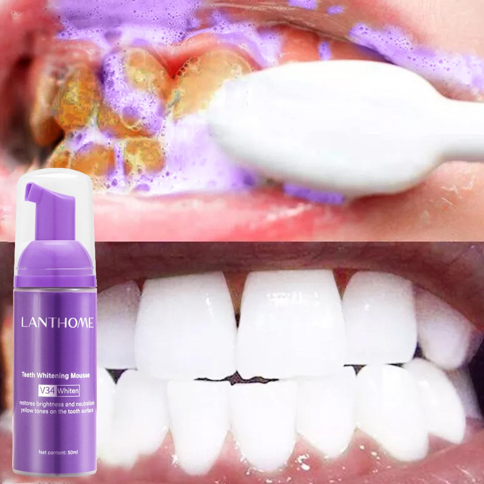 Pasta de dientes V34 Mousse pa - Teeth Whitening Best reseña y precio