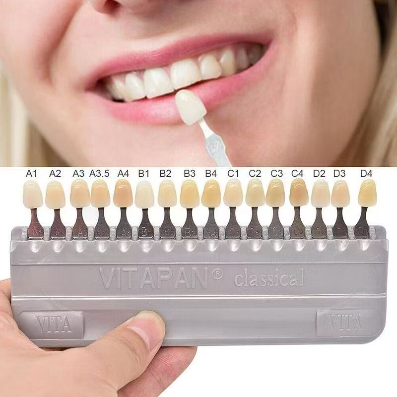 VITA-Guía de sombra de dientes - Teeth Whitening Shade Guide reseña y precio
