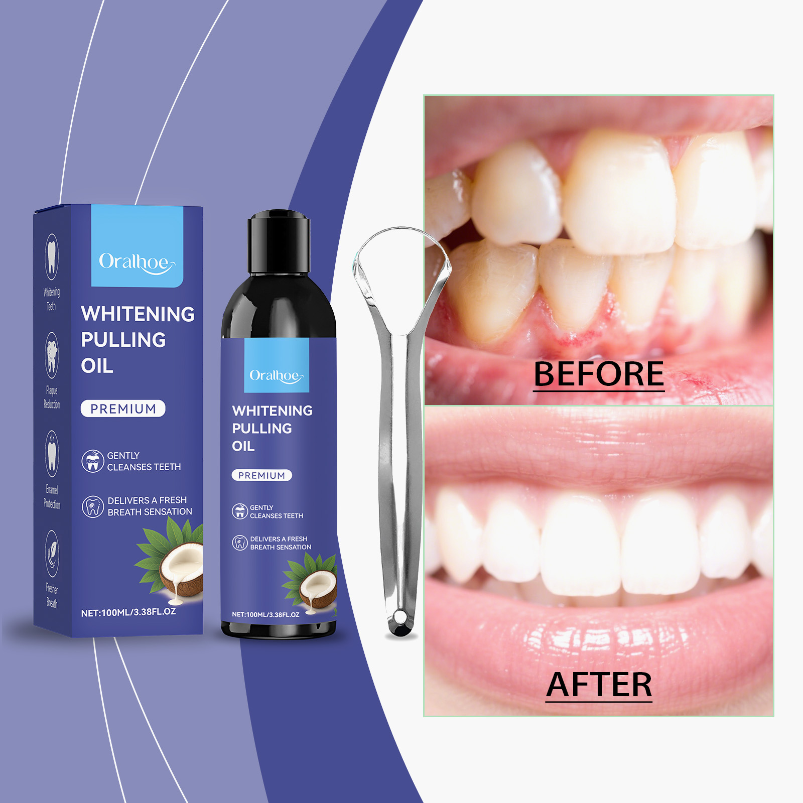 Enjuague bucal de aceite de co - Teeth Whitening With Coconut Oil reseña y precio