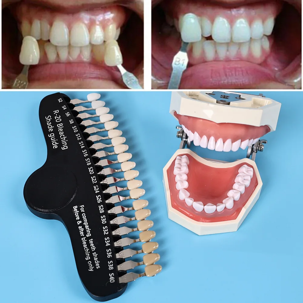 ELIJAH R-20 guía de sombra bla - Teeth Whitening Shade Guide reseña y precio