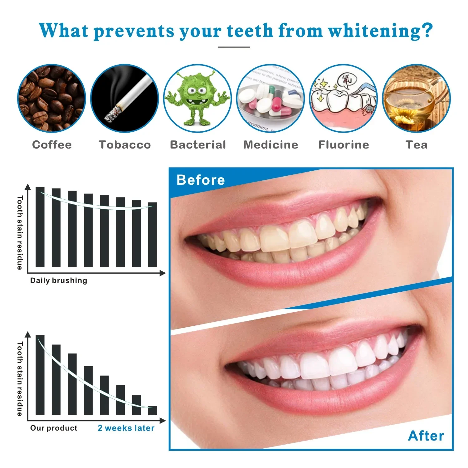 14/28 Uds. Tiras blanqueadoras - Teeth Whitening Effects reseña y precio