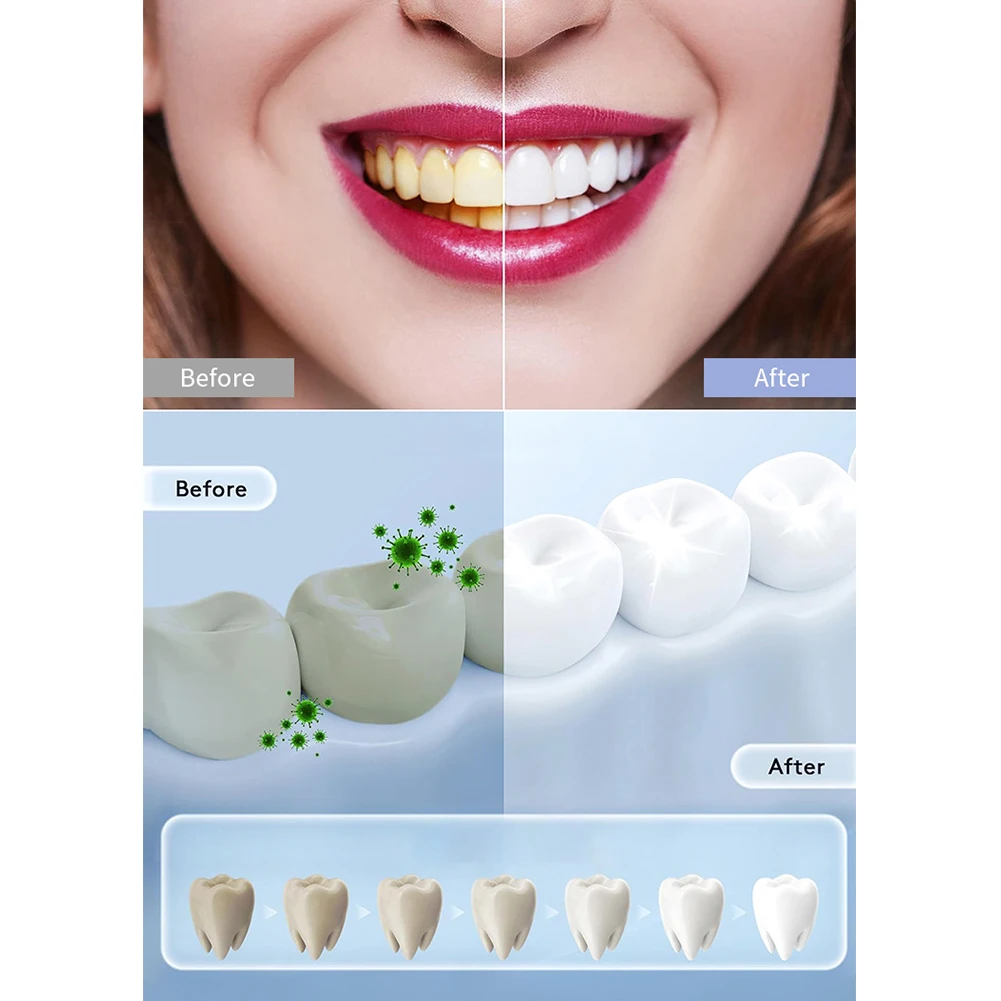 Lámpara LED inteligente para b - Teeth Whitening Uv reseña y precio