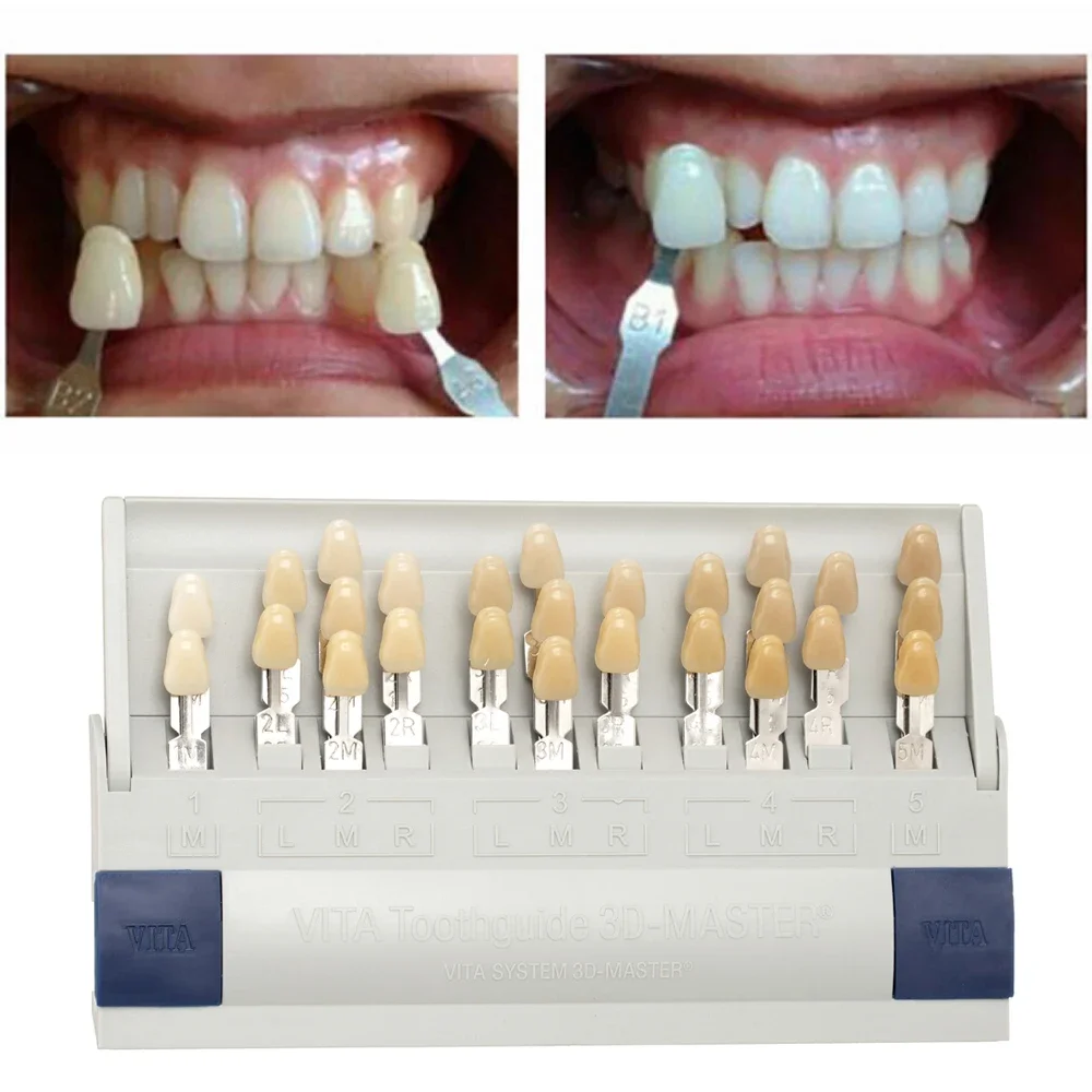 Vita 3D Master Dental Lab guía - Teeth Whitening Shade Guide reseña y precio